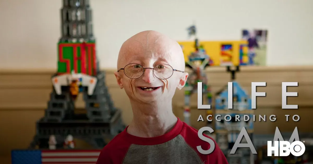 Life According to Sam