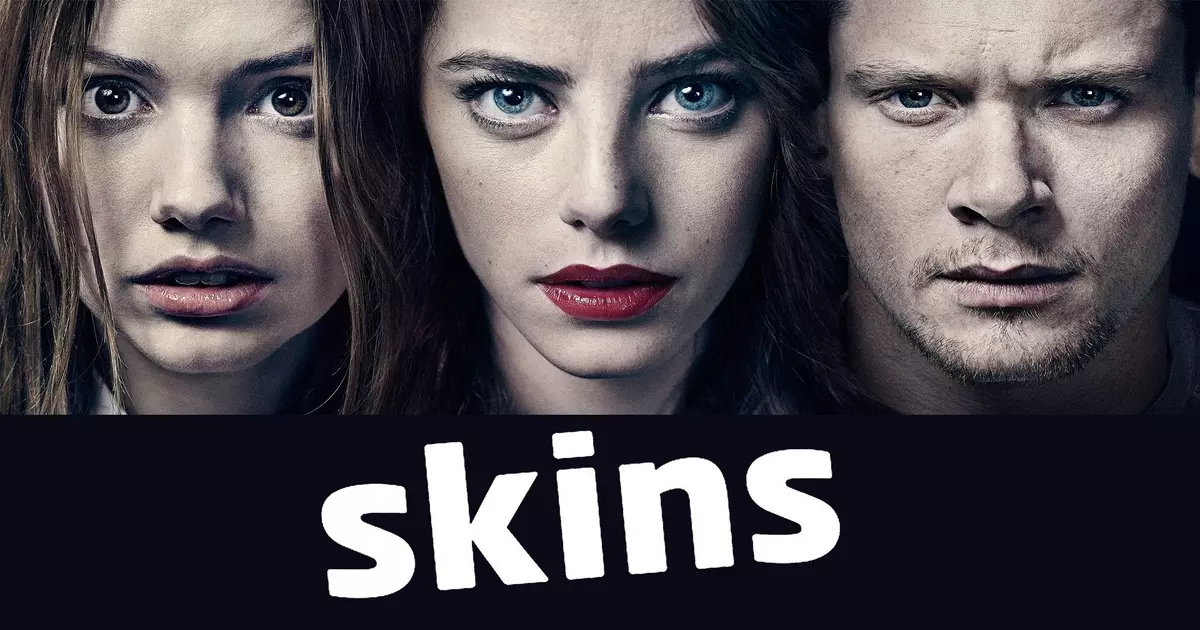 Skins UK